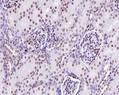 Polyclonal Rabbit anti-Human p56lck / LCK Antibody (phospho-Tyr505, IHC, IF, WB)
