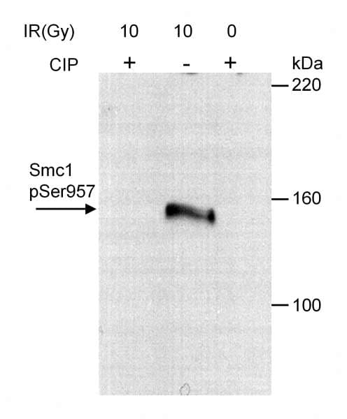 Polyclonal Rabbit anti-Human SMC1A / SMC1 Antibody (phospho-Ser957, WB)