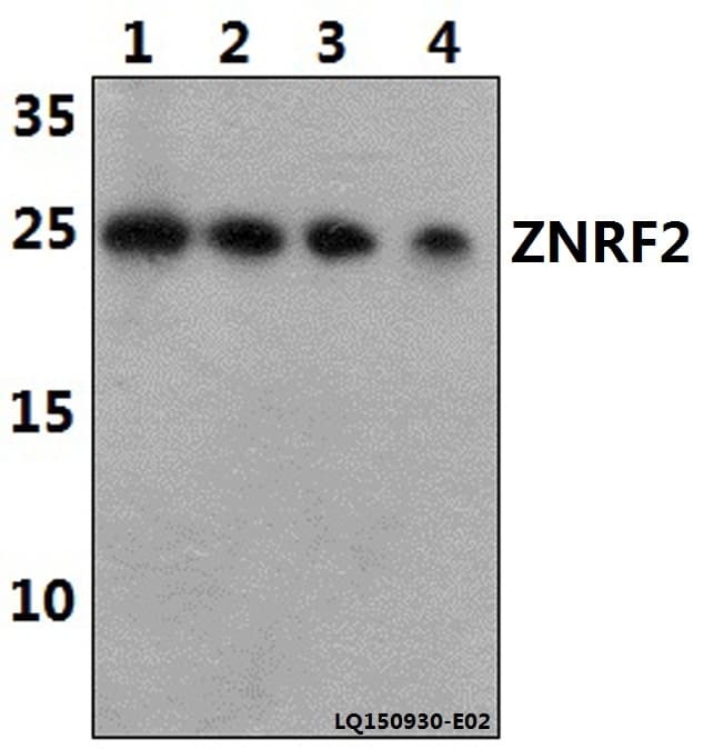 ZNRF2 Antibody