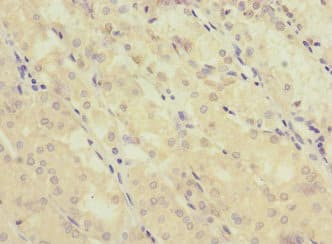 GRIK3 / GLUR7 Antibody
