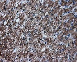 HMRF1L / MTRF1L Antibody (clone OTI1E3)