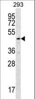 TBCEL / E-Like Antibody (aa385-413)