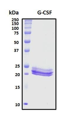 Pig CSF3 / G-CSF Protein (Recombinant His, N-Terminal)
