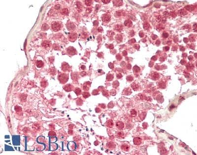 IHC-plus™ TATDN3 Antibody