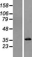 PPA1 Protein (Over-Expression Lysate Myc-DDK (Flag))
