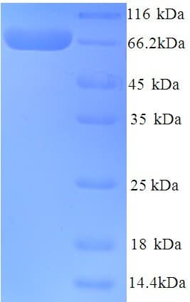 Human BCHE / Cholinesterase Protein (Recombinant His)