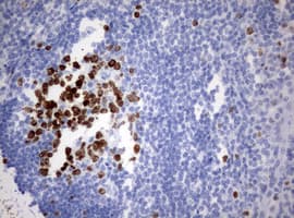MKI67 / Ki67 Antibody (aa1160-1493, clone OTI15A4)