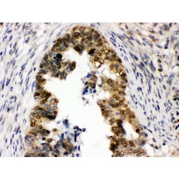 UHRF1 Antibody (aa14-51)