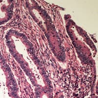 Polyclonal Rabbit anti-Human B4GALT2 Antibody (C-Terminus, IHC, WB)