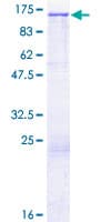 Human MMRN2 / Emilin 3 / EndoGlyx-1 Protein (Recombinant GST)