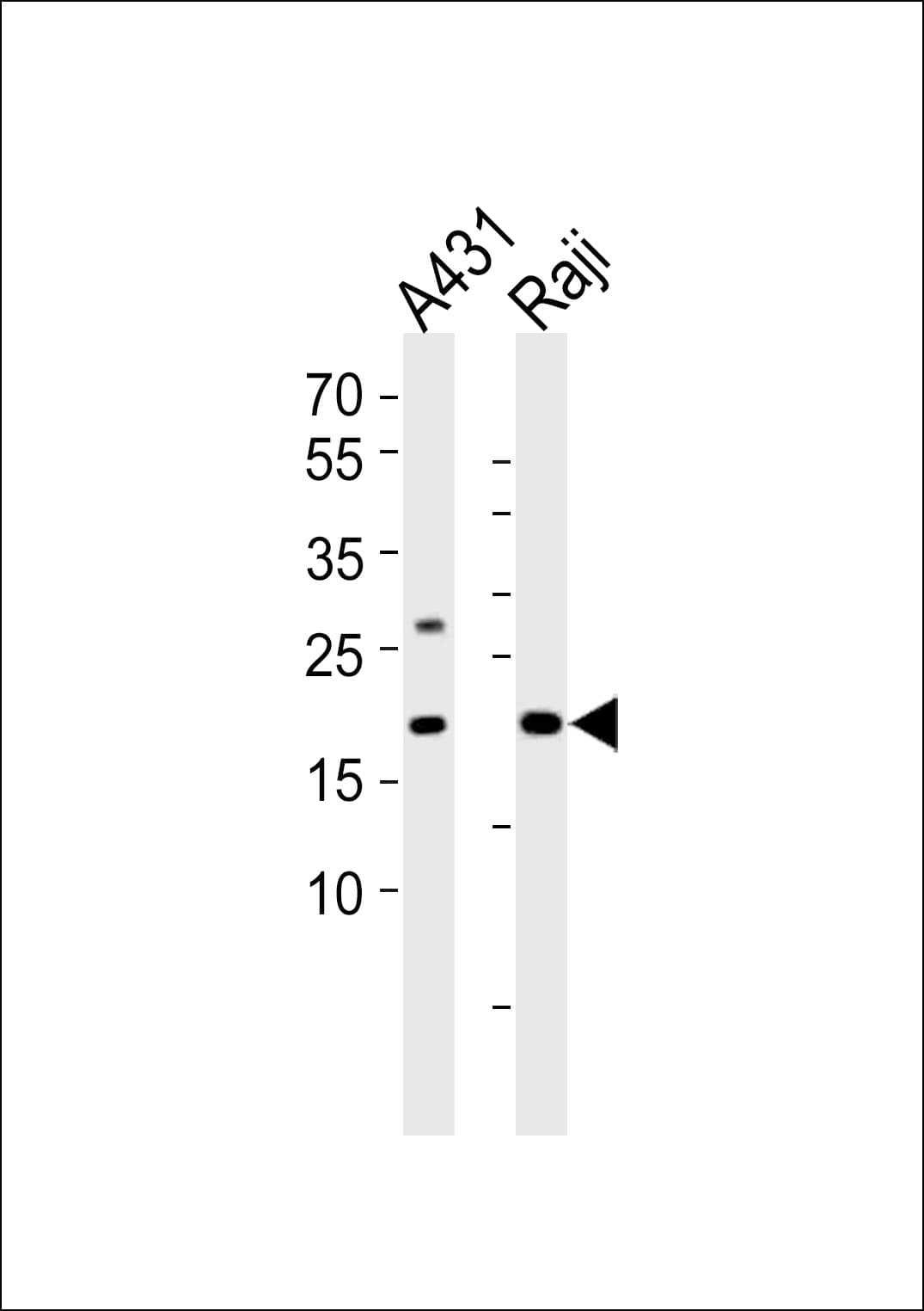 PSMB9 Antibody (aa205-239)