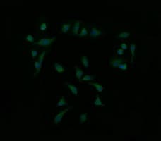 MAP2K1 / MKK1 / MEK1 Antibody (clone OTI2F12)