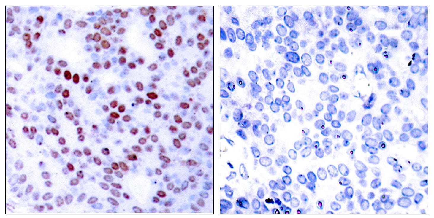 JUN / c-Jun Antibody (p243)
