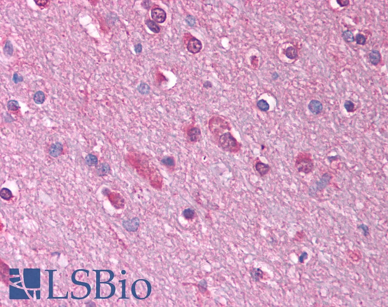 GABRQ / THETA Antibody (aa31-80)