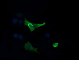 MAP2K1 / MKK1 / MEK1 Antibody (clone OTI4F1)