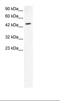 Polyclonal Rabbit anti-Human GATA2 Antibody (aa58-107, IHC, WB)