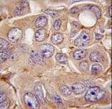 MMP12 Antibody (aa391-420)