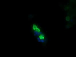 MDM4 / MDMX Antibody (clone OTI2D11)