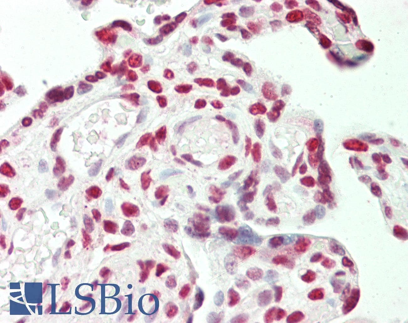 IHC-plus™ STAG1 / SA1 Antibody (aa25-75)