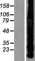 Human MT1A / Metallothionein 1A Protein (Over-Expression Lysate Myc-DDK (Flag))