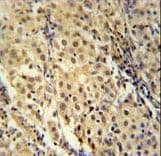 Polyclonal Rabbit anti-Human FOXC2 Antibody (aa159-186, IHC, WB)
