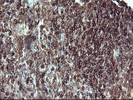 CD45 / LCA Antibody (clone OTI1F6)