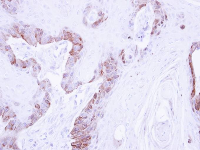 LIMK2 Antibody (aa294-655)