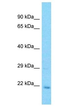UFC1 Antibody (aa44-93)