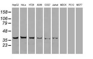 DFFA / ICAD / DFF45 Antibody (clone OTI3F12)