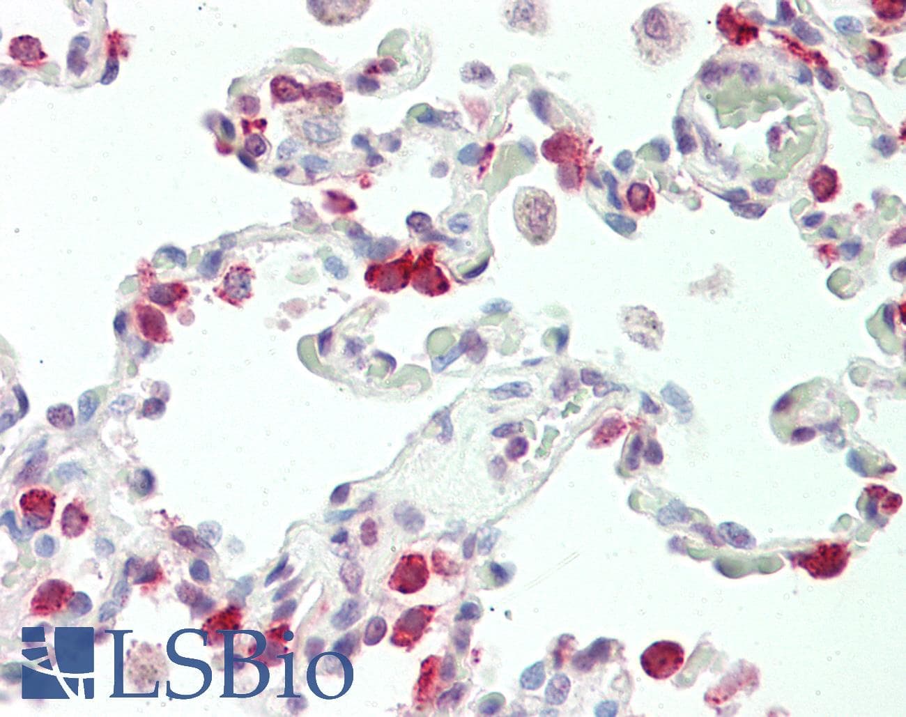 IHC-plus™ SFTPC / Surfactant Protein C Antibody (aa1-30)