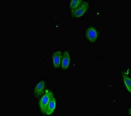Polyclonal Rabbit anti-Human SMOC1 Antibody (IHC, IF, WB)