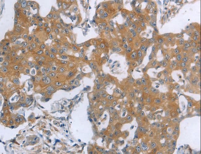 TNK2 / ACK1 Antibody