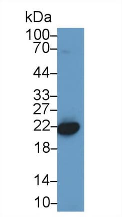 CBX3 / HP1 Gamma Antibody (aa1-183)