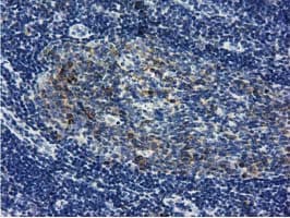 LIN7B Antibody (clone OTI1C9)
