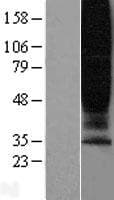 Human GPR45 Protein (Over-Expression Lysate Myc-DDK (Flag))