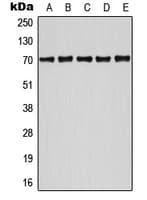 Polyclonal Rabbit anti-Human ATF2 Antibody (phospho-Ser498, WB)