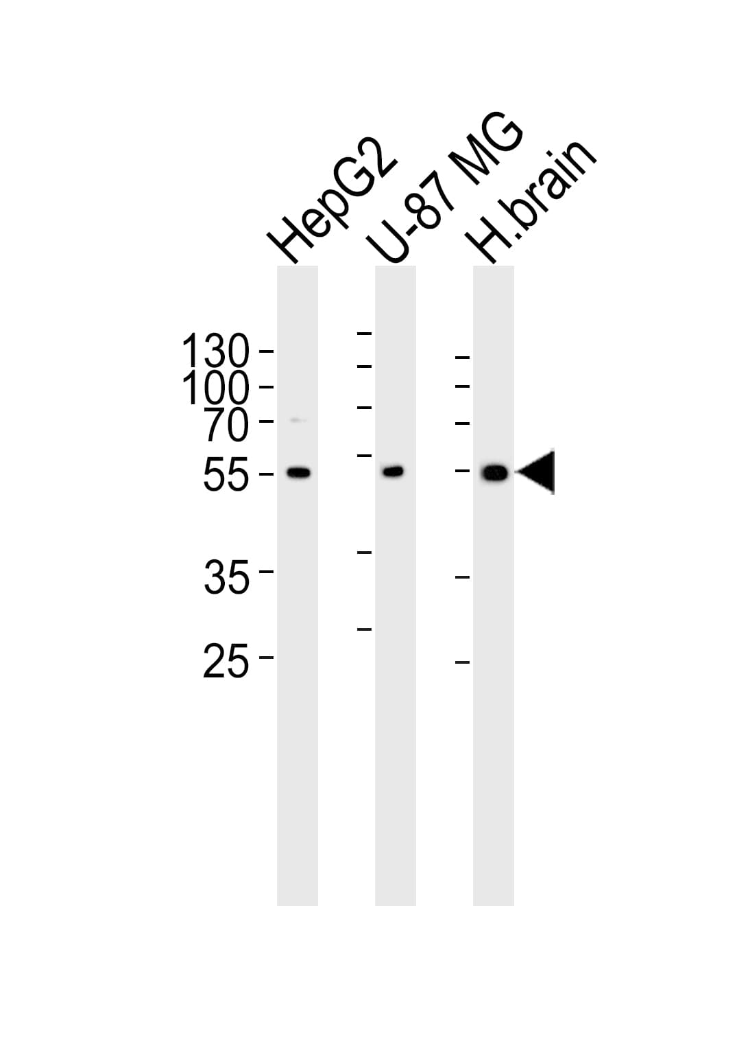 Polyclonal Rabbit anti-Human RGS20 / RGSZ1 Antibody (aa150-184, WB)