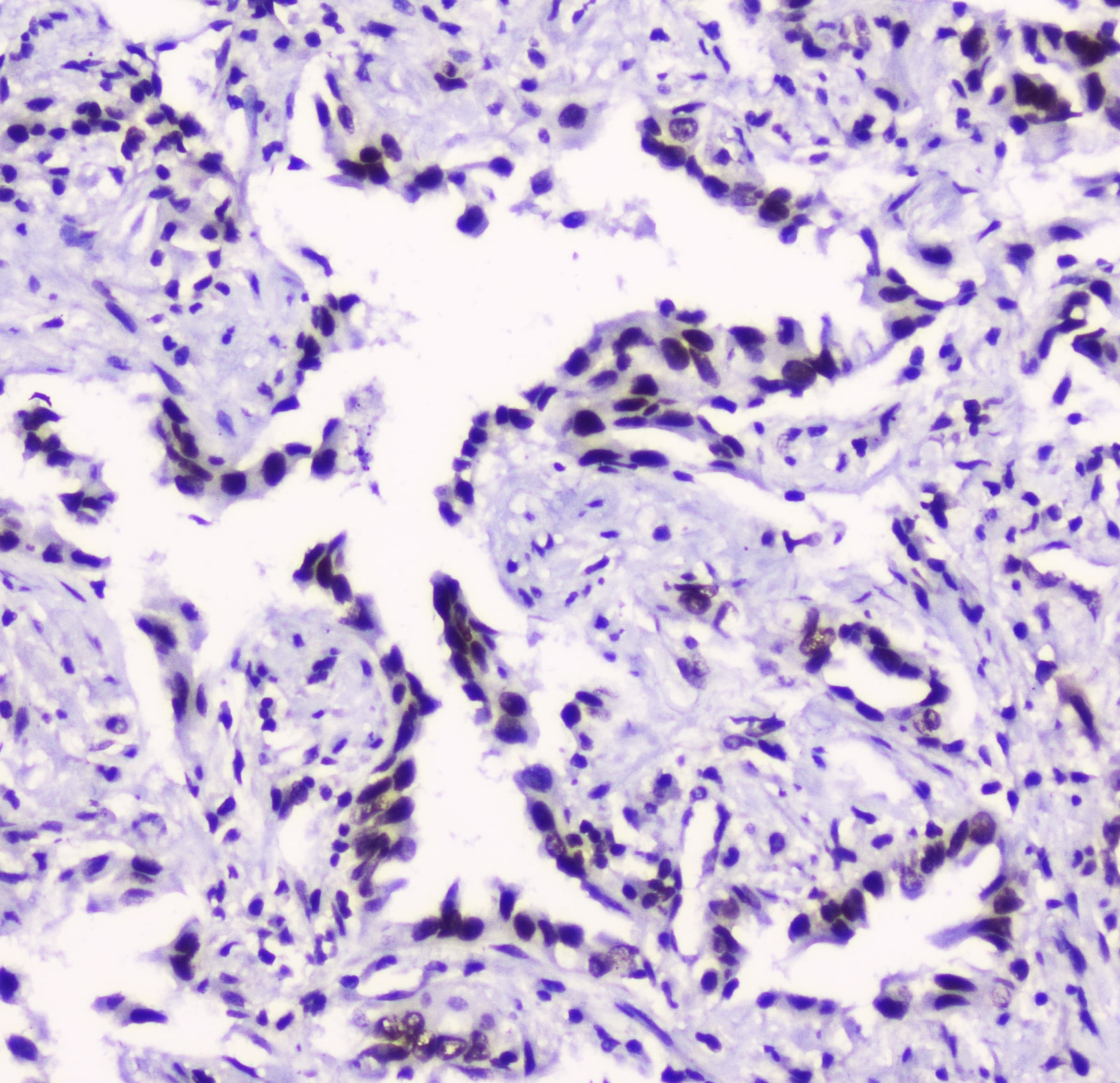 SMC3 / HCAP Antibody