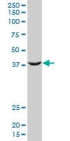 PCGF2 / MEL-18 Antibody (clone 4D6)