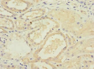 Polyclonal Rabbit anti-Human GFM2 Antibody (IHC)