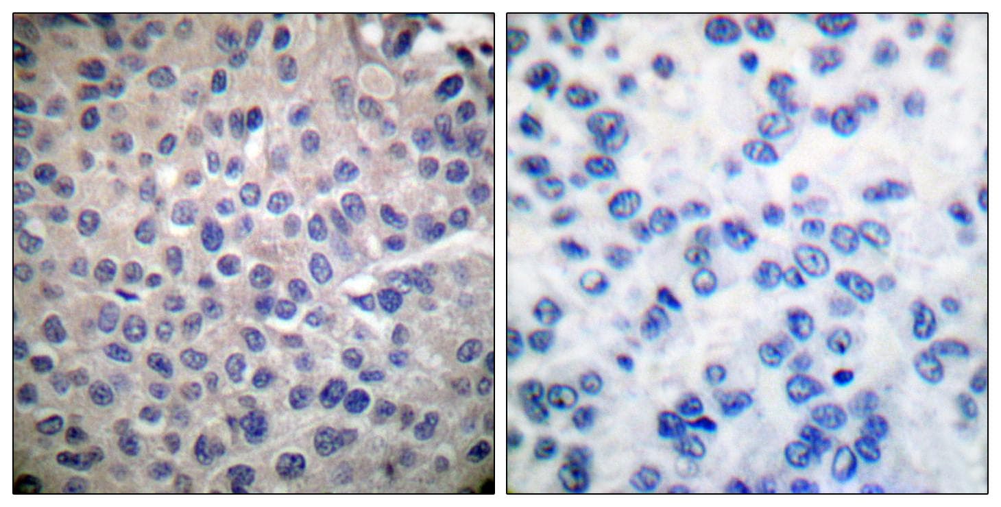 STAT4 Antibody (p693)