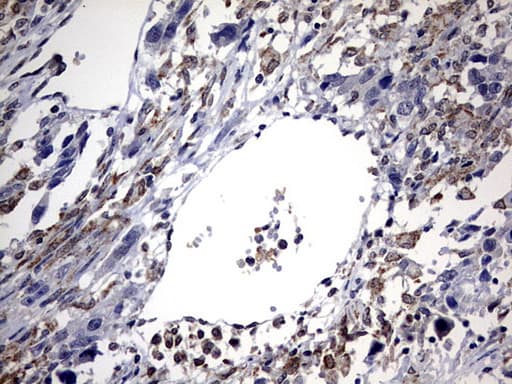 Monoclonal Mouse anti-Human ALDP / ABCD1 Antibody (clone OTI2C12, aa508-745, IHC, WB)