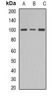 Polyclonal Rabbit anti-Human DNM1 / Dynamin Antibody (C-Terminus, IHC, WB)