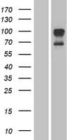 TMEM142A / ORAI1 Protein (Over-Expression Lysate Myc-DDK (Flag))