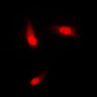 PathPlus™ Polyclonal Rabbit anti-Human KRT8 / CK8 / Cytokeratin 8 Antibody (C-Terminus, IHC, IF, WB)