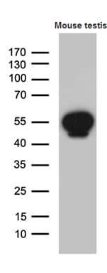 MSY2 / YBX2 Antibody (clone OTI3B5)