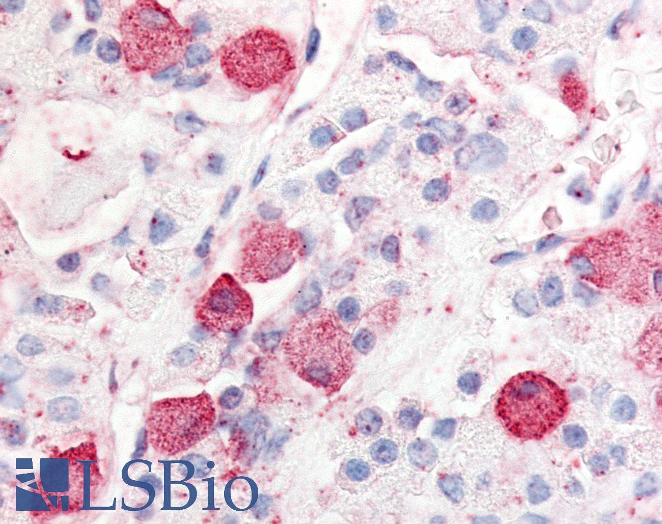 IHC-plus™ PRLHR / GPR10 Antibody (Extracellular Domain)