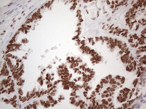 Monoclonal Mouse anti-Human HNRNPL / hnRNP L Antibody (clone OTI4E5, aa270-502, IHC)