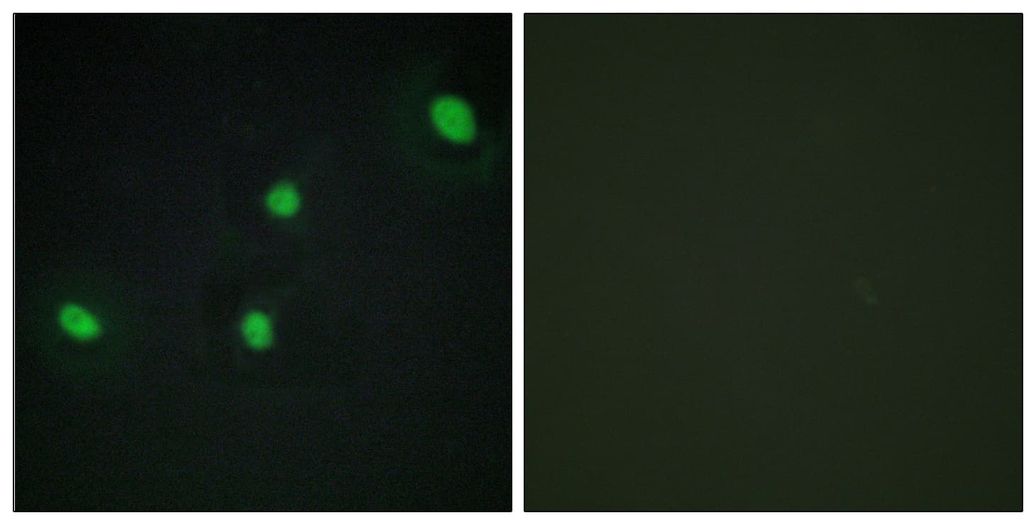 Polyclonal Rabbit anti-Human CDCA4 Antibody (aa121-170, IHC, IF)