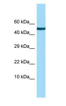 CHRDL2 Antibody (aa143-192)